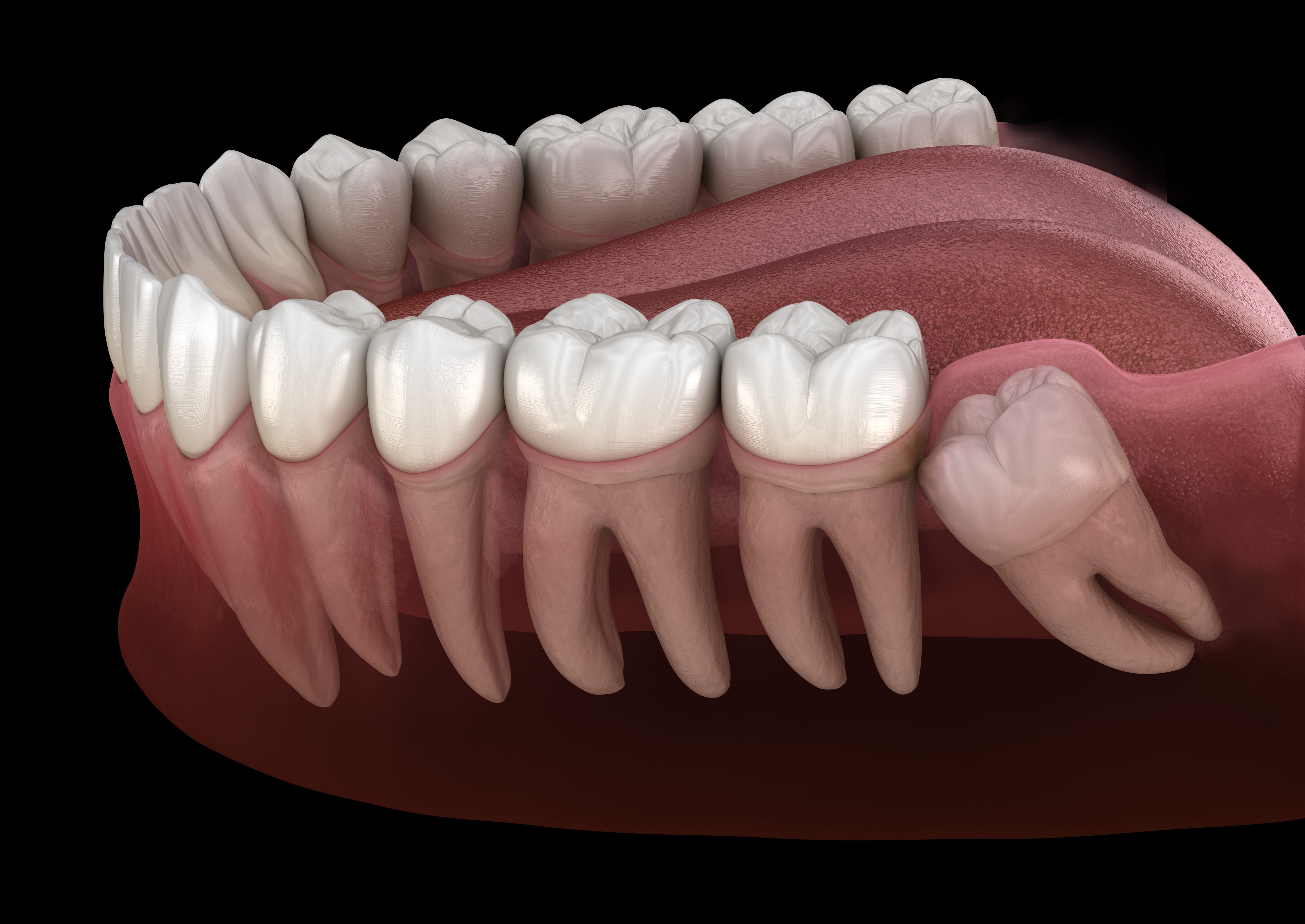 The Ultimate Tooth Whitening Guide: Tips from Chitra Dental Experts