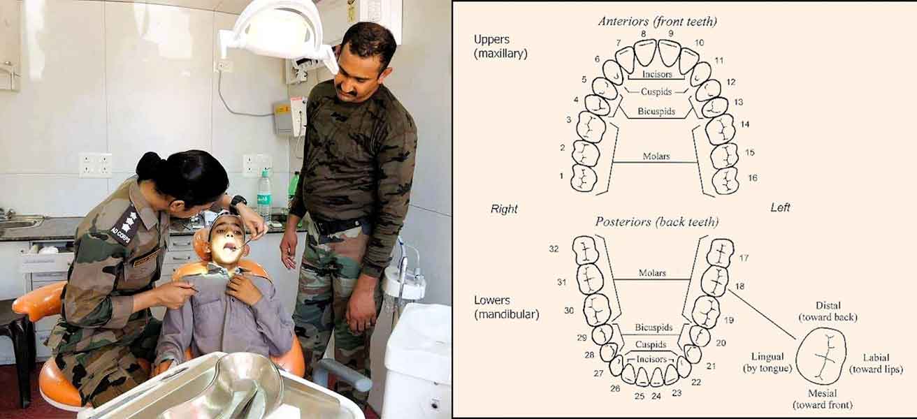 Why Dental Health Matters in Defence Exams