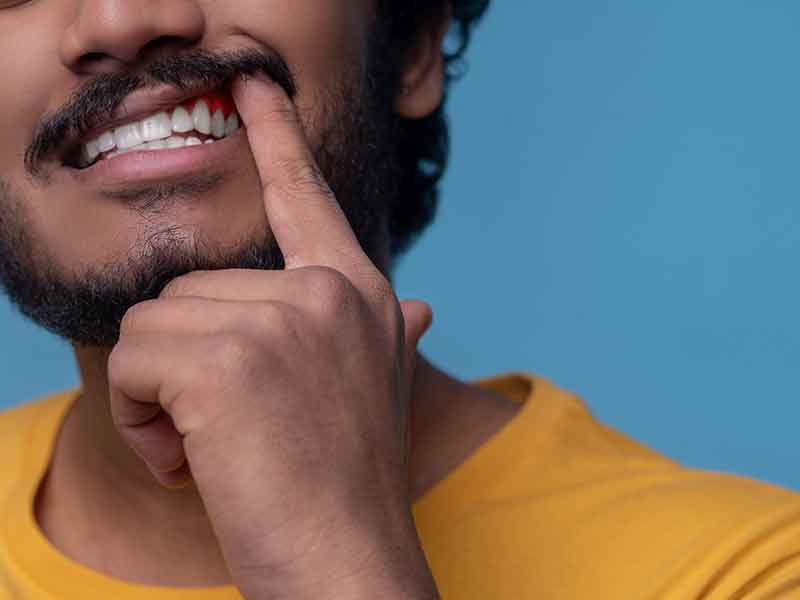 Healthy orthodontic smile alignment