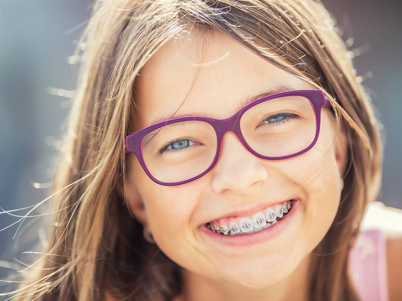 Braces for Children: Everything You Need to Know for the Perfect Smile