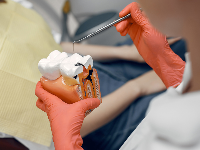 The Future of Root Canal Treatments: Regenerative Endodontics at Chitra MultiSpeciality Dental Clinic